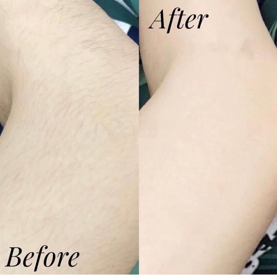 [Chính hãng] Kem tẩy lông VEET 50gr - Tẩy Lông Siêu Sạch An toàn cho da nhạy cảm