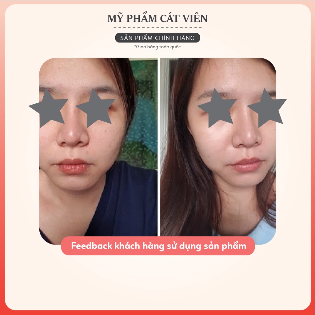 Serum dưỡng ẩm Derma cấp nước, phục hồi da, căng bóng da trẻ hóa, dưỡng trắng Me'dream AQUA SERUM 50ml