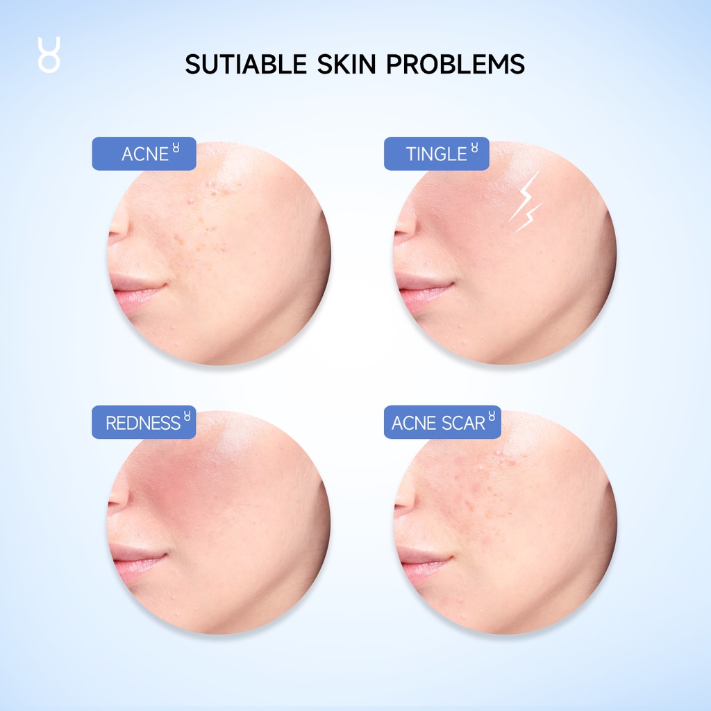 FOCALSKIN Serum Lá Trà CAMELLIA 3% RAU MÁ + 3% NIACINAMIDEHỗ Trợ Phục Hồi Da Toàn Diện 15ML/30ML