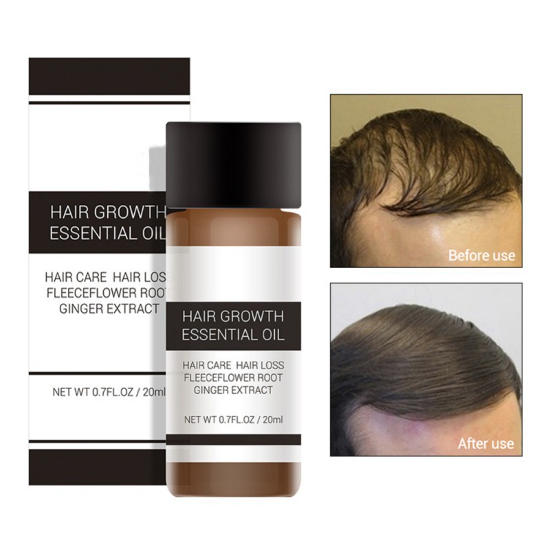 LANBENA Tinh chất kích thích mọc tóc nhanh 20ml