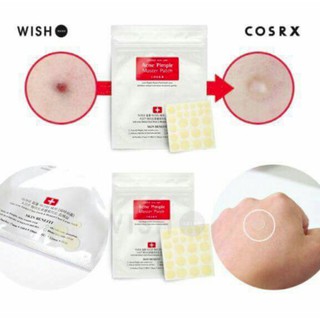 Miếng dán mụn Cosrx Acne Pimple Master Patch