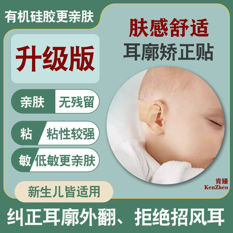 Infant silicone hồ sơ sửa chữa bé chống lừa đảo chính xác tai mới cố định biến dạng thể hiệnnội  địa