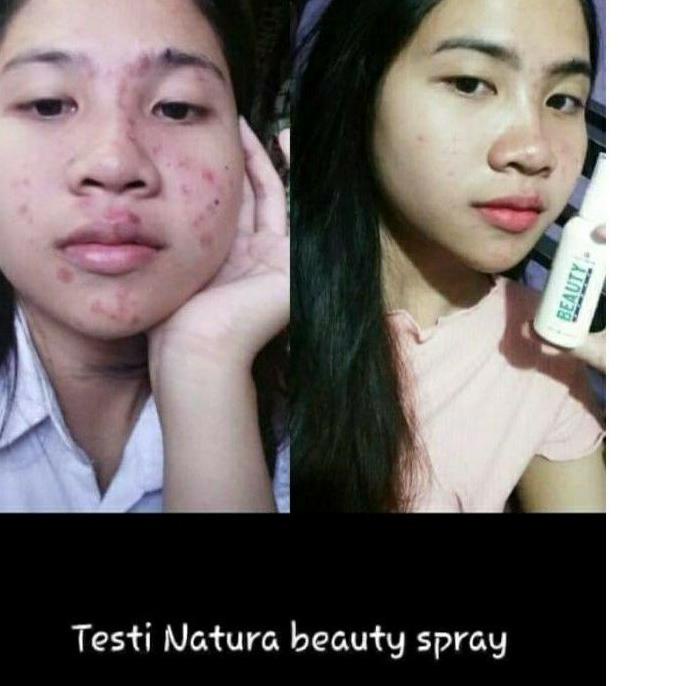 Cái thứ hai này! Tấm trải giường phun sương làm đẹp Lr075 Natura NBS Beuty Biuty Sprey Natura | BigBuy360 - bigbuy360.vn