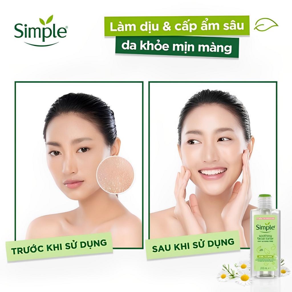 Toner Simple Nước Hoa Hồng Cân Bằng Da Dưỡng Ẩm Làm Dịu Lành Tính 200ml