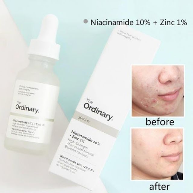 Tinh chất giảm mụn thâm The Ordinary Niacinamide 10% + Zinc 1%