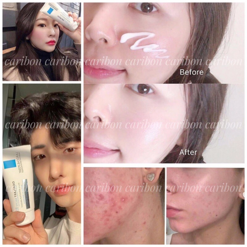 KEM DƯỠNG LAROCHE POSAY CICAPLAST BAUME B5