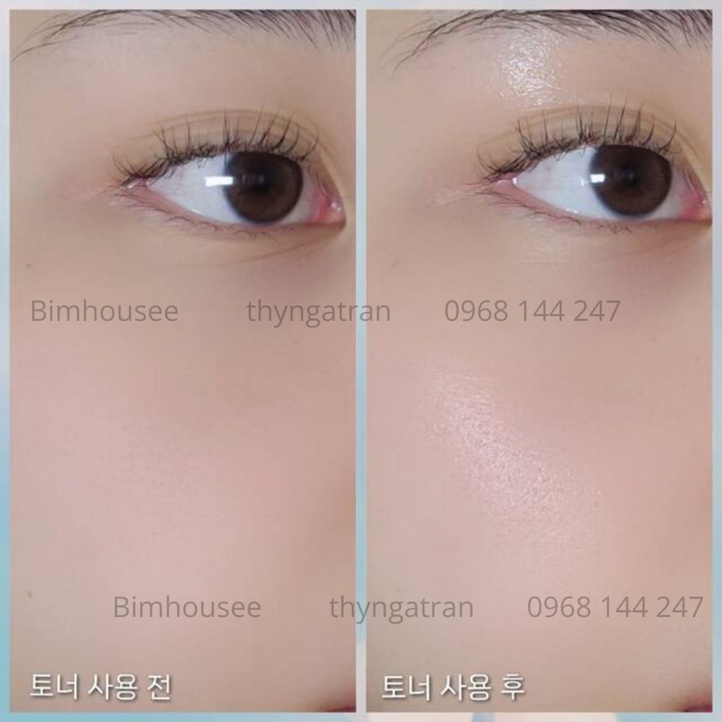 MBC M106 Nước hoa hồng cho da mụn, nhạy cảm Fraijour Heartleaf Blemish 500ml