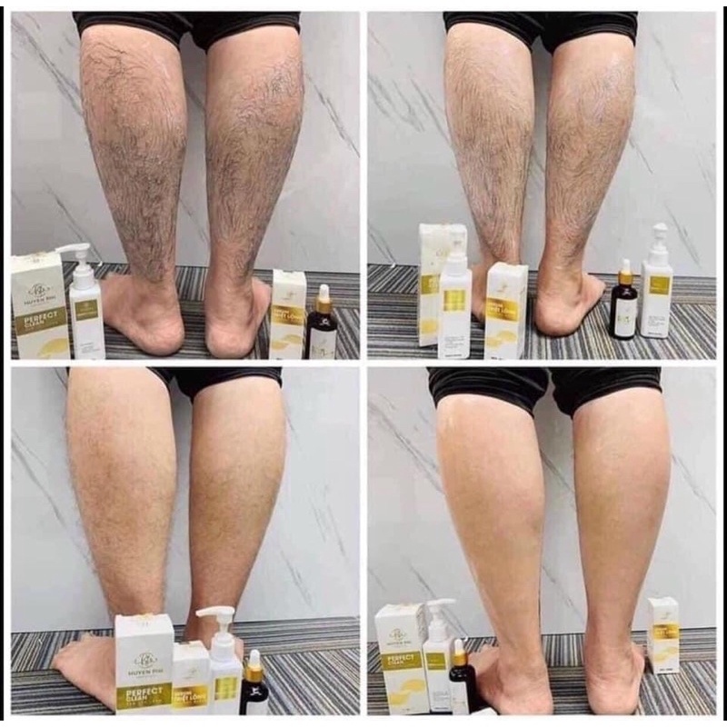 Kem tẩy lông huyền phi tặng serum t riệt lông