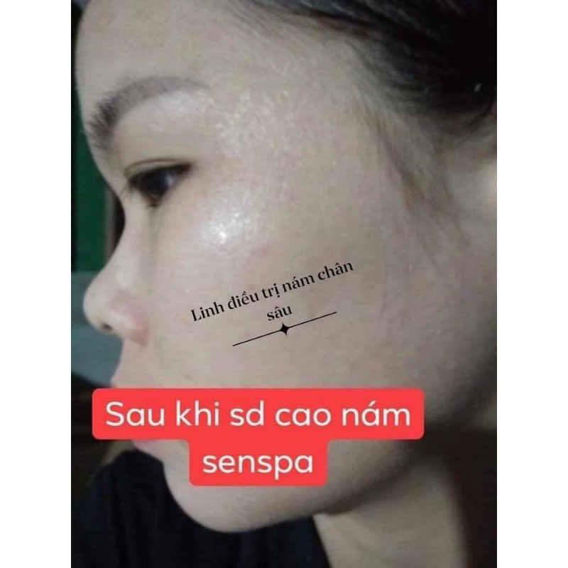 Dr.sen Cao Nám Sen Spa