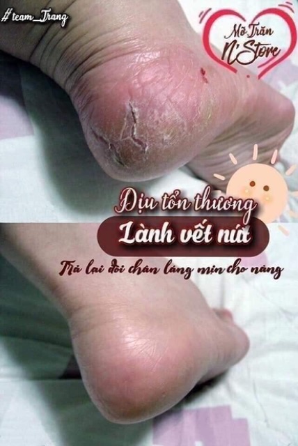 MỠ TRĂN N’STORE MỠ TRĂNG NGUYÊN CHẤT N’STORE by THANH NHI [Hàng chính hãng mẫu mới có hộp]