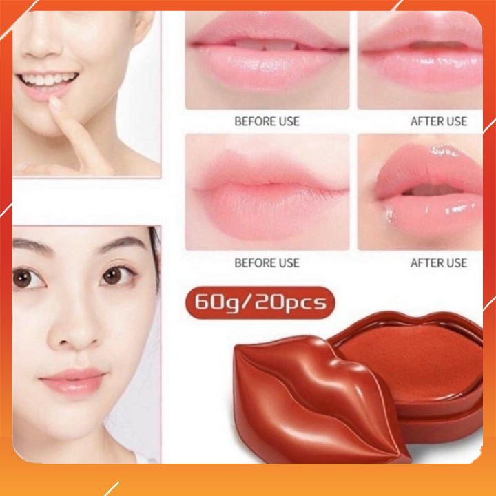 MẶT NẠ MÔI HOA HỒNG DƯỠNG ẨM MỀN MÔI CĂNG MỌNG [hộp 20 miếng]