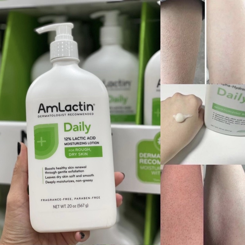 (U.S.A) Kem Dưỡng Ẩm AmLactin Daily Lotion 567g