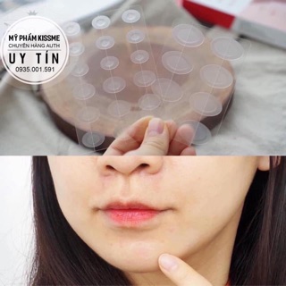 Miếng dán  Cosrx Acne Pimple Master Patch (Nhập khẩu chính hãng)