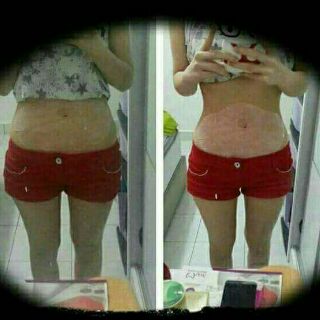 Sỉ 10 hộp (50 miếng) dán tan mỡ bụng