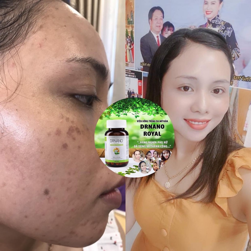 Viên Uống Trắng Da Dian Beauty, [Mua 1 Tặng 2] ,Mua 2 Giảm thêm 59K, FreeShip, Trắng toàn thân, mờ nám | BigBuy360 - bigbuy360.vn