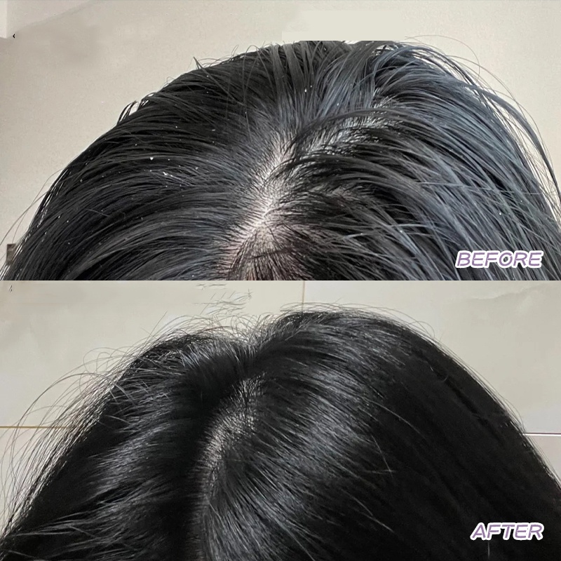 Dầu Gội Muối Biển Rnw Chống Gàu Kiểm Soát Dầu Cho Da Đầu Trọng Lượng 220g