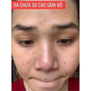 Cao Mụn Sâm Đõ 36 vị 15GR _MEEA OGRIGIN