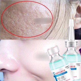 Tinh chất dưỡng shrinkage pore 30ml DD G204