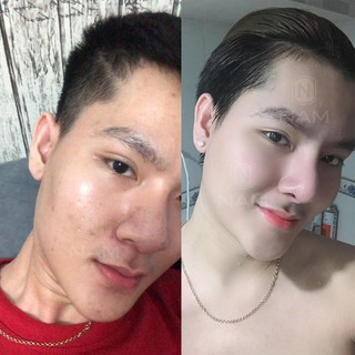 Serum Dưỡng Da Mặt NAM 20ml