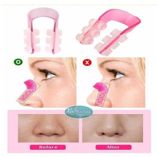Kẹp nâng cao mũi Nose Up