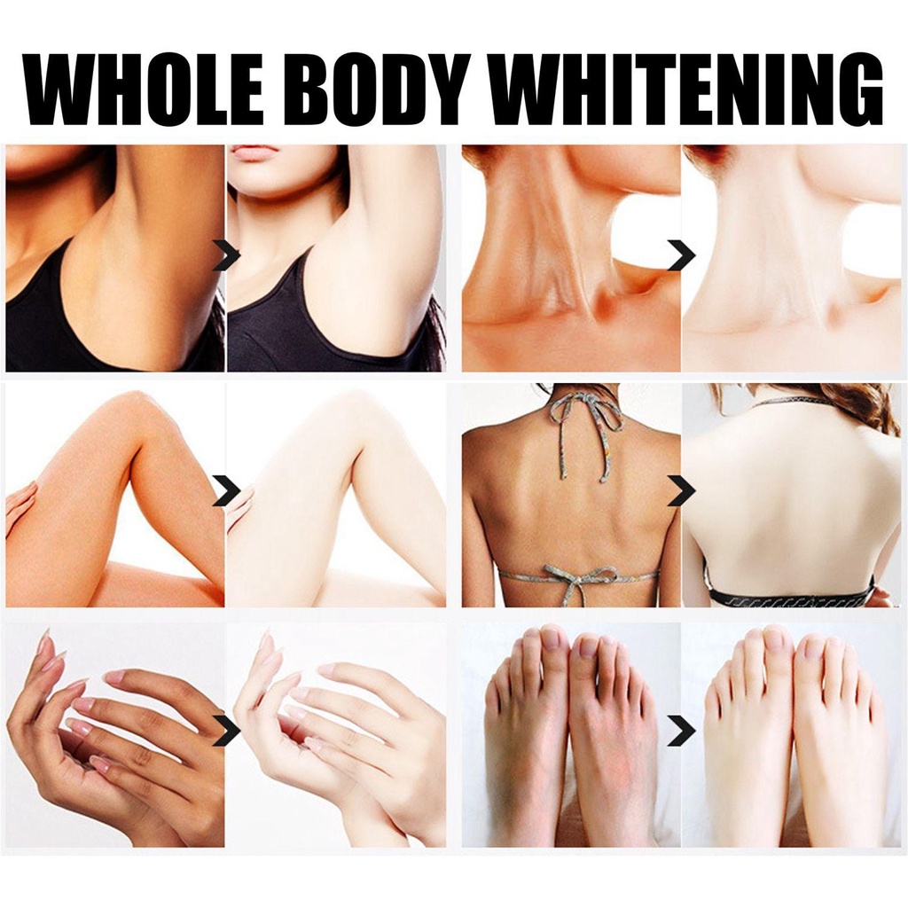 Kem Dưỡng Trắng Da Vùng Cổ/Đầu Gối/Đầu Gối Hiệu Quả
