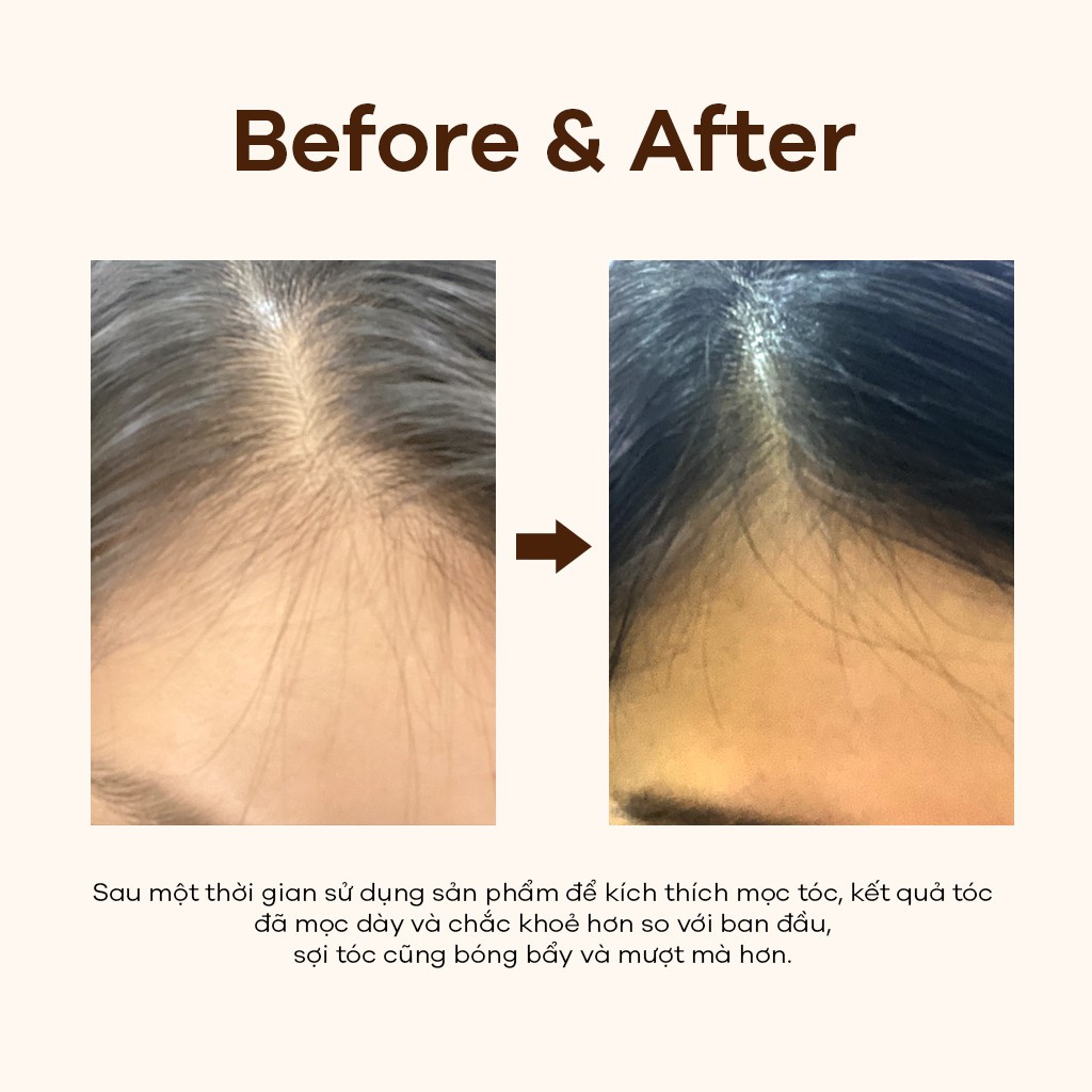 Tinh chất dưỡng bảo vệ phục hồi tóc, giúp tóc chắc khỏe giảm gãy rụng dạng xịt tiện lợi Herbal Keratin Hair Booster 90ml | BigBuy360 - bigbuy360.vn