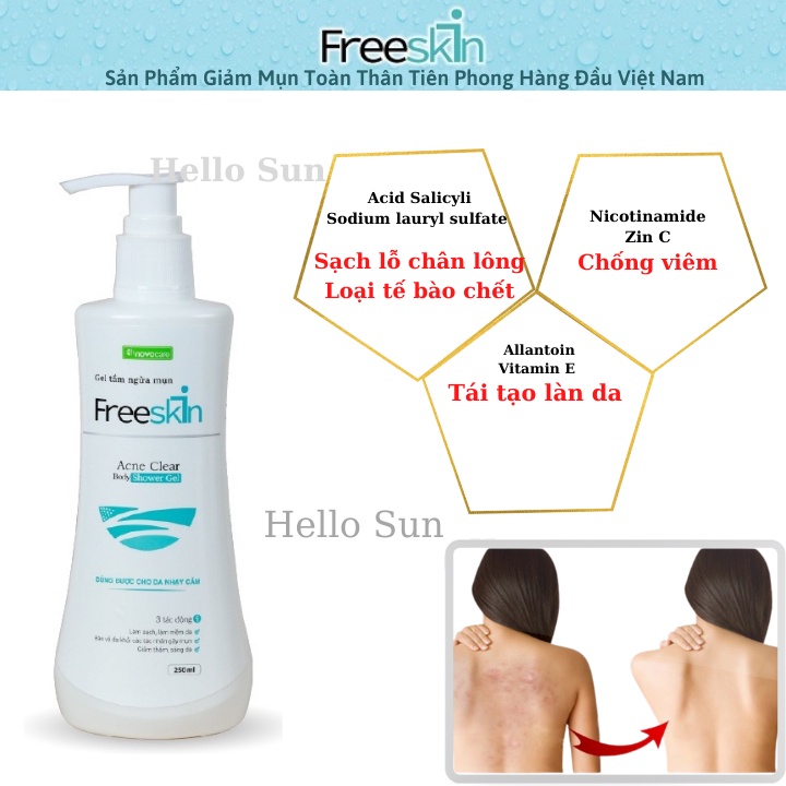 Sữa Tắm Giảm Mụn FreeSkin Chai 250ml, Giảm Mụn, Mờ Thâm, Sáng Da, Hàng Chính Hãng Thơm Novopharm