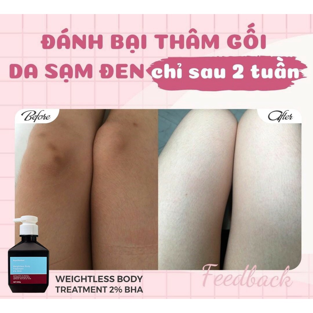 Kem Tẩy Tế Bào Chết Royal Retinol Weightless Body Treatment 2% BHA