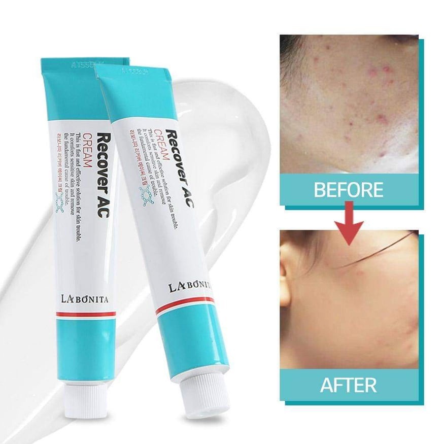 Kem giảm mụn dưỡng da phục hồi – LaBonita Recover AC Cream 50ml