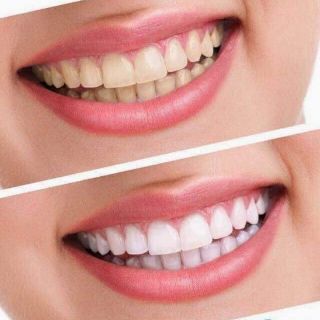 BỘT THAN TRE HOẠT TÍNH TRẮNG RĂNG CAO CẤP ZENPALI ( Tặng 1tuyp kem đánh răng SENSODYNE )