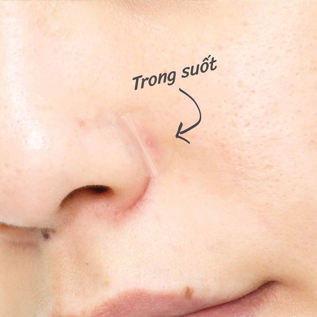 [1 Hộp 12 gói] Miếng dán mụn Hàn Quốc thương hiệu Care Zone mỏng, trong suốt làm giảm mụn sưng đỏ và thâm