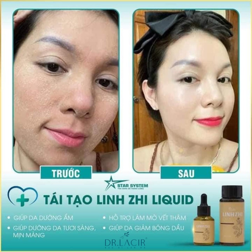 Tái Tạo Da Sâm Linh Zhi Loại bỏ mụn thâm, Da xỉn màu, Lỗ chân lông to, Sạm, Nám DR.LACIR 30 ml vs 110 ml LM36