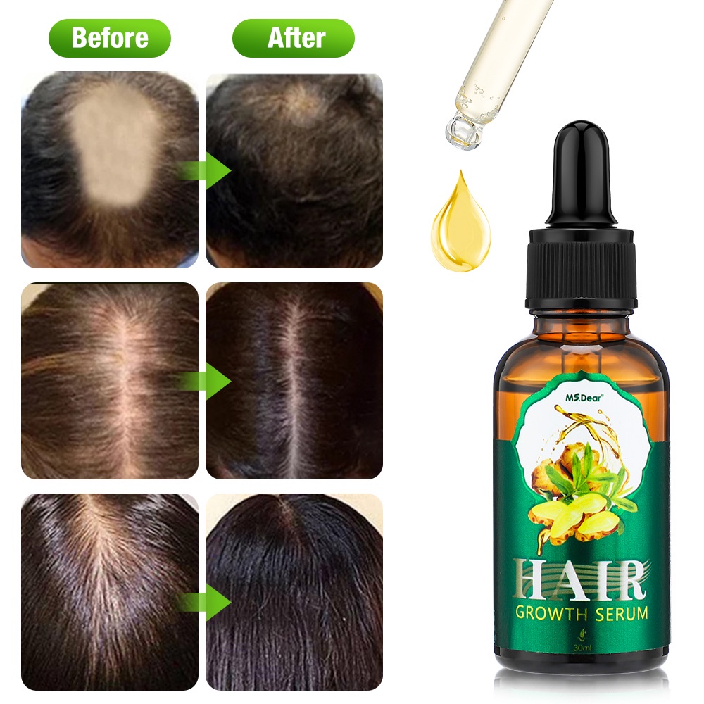 Tinh Chất Gừng Kích Thích Mọc Tóc Và Phục Hồi Tóc Hư Tổn Thương Hiệu
