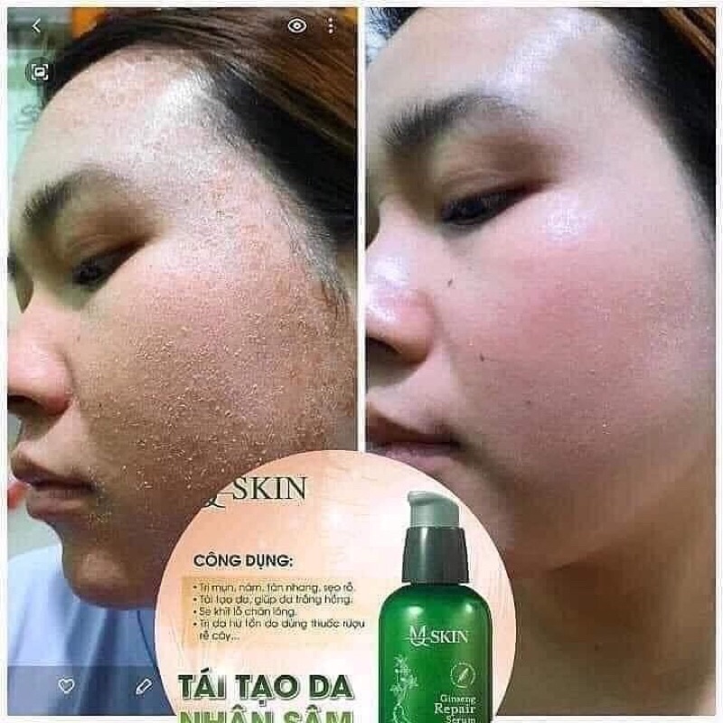 SERUM TÁI TẠO NHÂN SÂM MQ SKIN