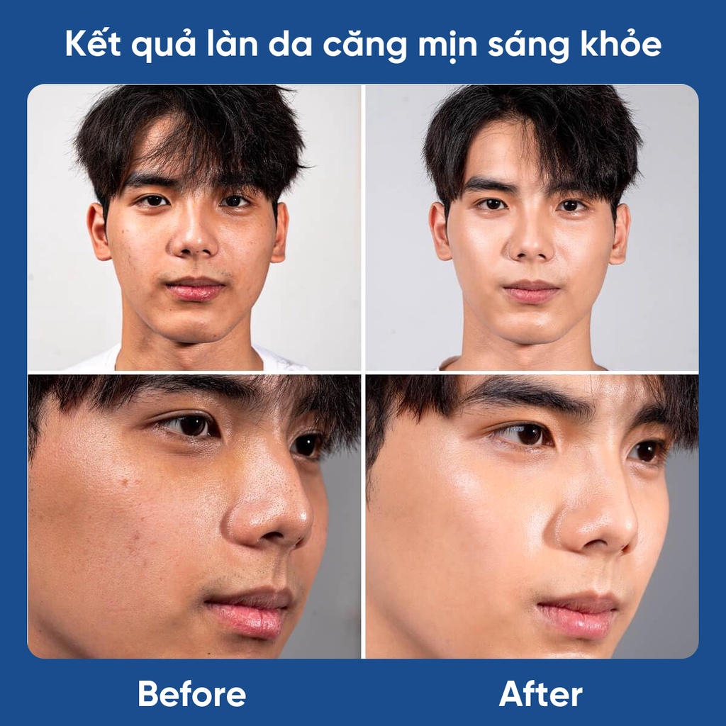 Serum dưỡng trắng da cho nam 7 in 1 Dabo Black Force Serum For Men 120ml - Mỹ phẩm chính hãng 30Shine