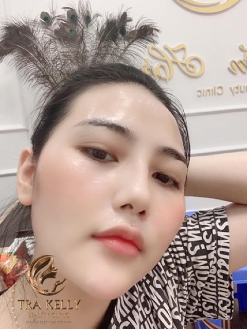Cấy ủ Mulwang Trắng Bóng Mịn xoá thâm nám