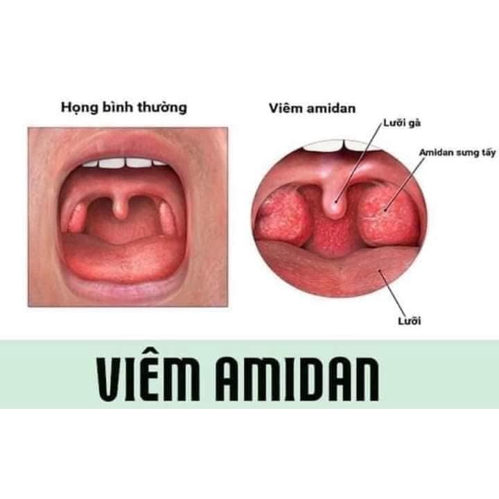 Tinh Dầu Răng Miệng Hỗ Trợ Giảm Hôi Miệng, Sâu Răng, Viêm Lợi Chảy Máu Chân Răng