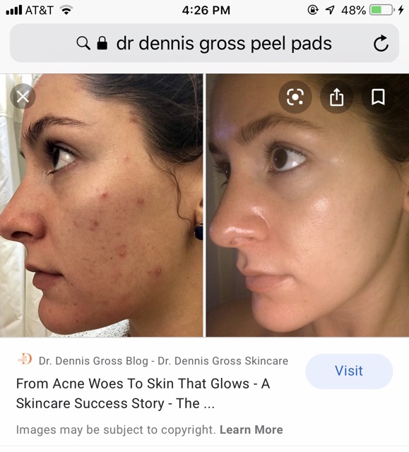 [Dr Dennis Gross] MIẾNG PAD PEEL DA DR DENNIS GROSS DAILY PEEL Alpha Beta Extra Strength - Tẩy tế bào chết hằng ngày