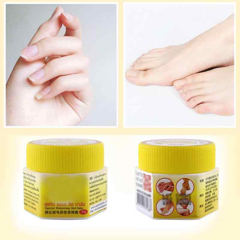 Kem Chăm Sóc Da Tay Chân Chống Nứt Nẻ Dưỡng Ẩm Hiệu Quả Tiện Lợi (KEM CHUỐI)