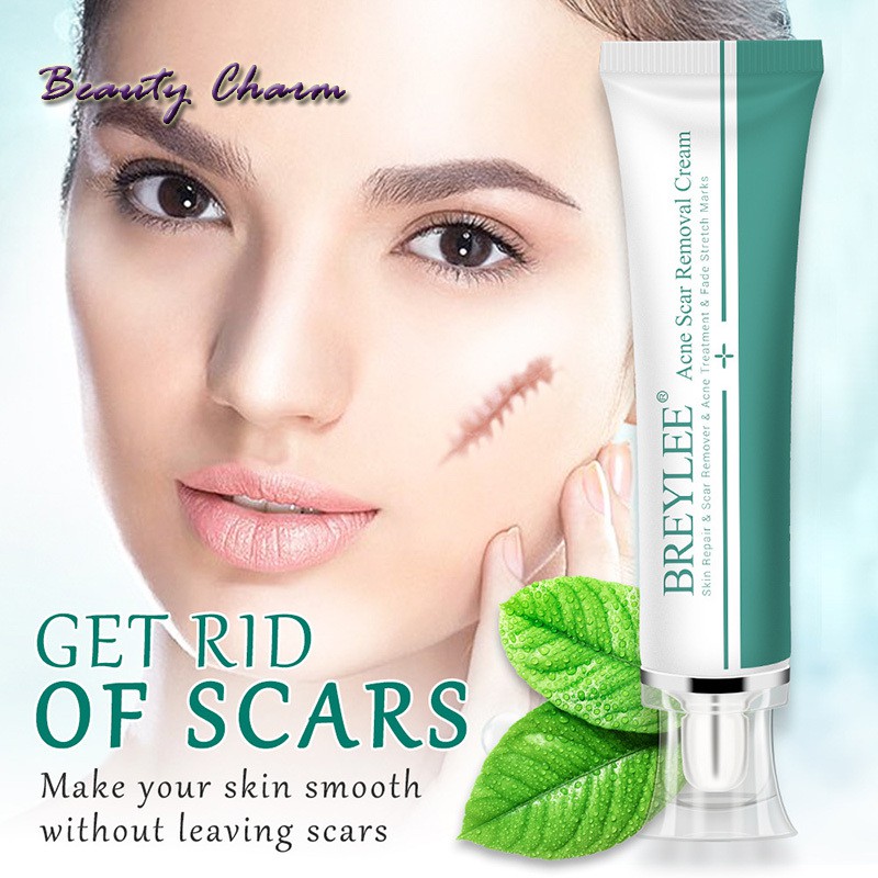 [Hàng mới về] Kem Hỗ Trợ Giảm sẹo 30ml chuyên dụng | BigBuy360 - bigbuy360.vn