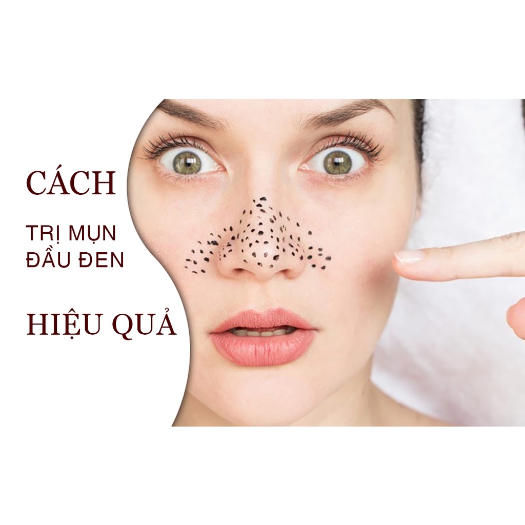 Sữa dưỡng ẩm cho da mụn LACO Lotion Acnee