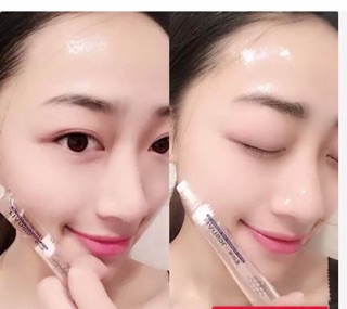 Combo 5 Ống Tinh Chất HA Dưỡng Da