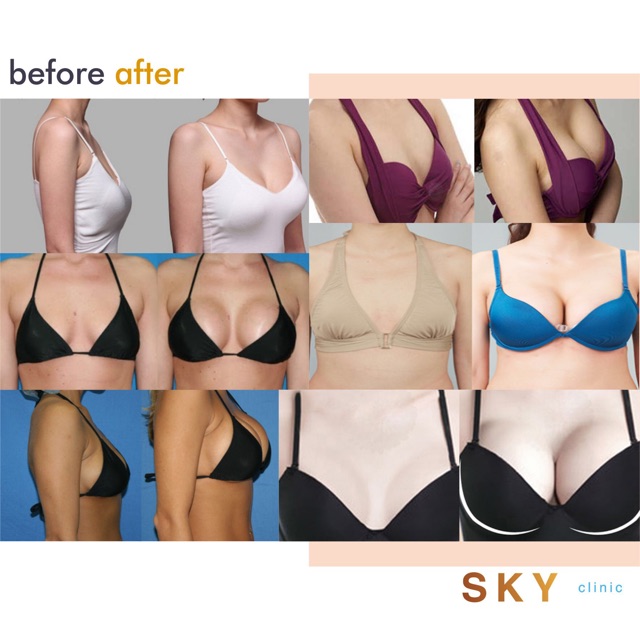 Gel Làm Săn Chắc Và Nâng Ngực Skyderm 50GR | BigBuy360 - bigbuy360.vn