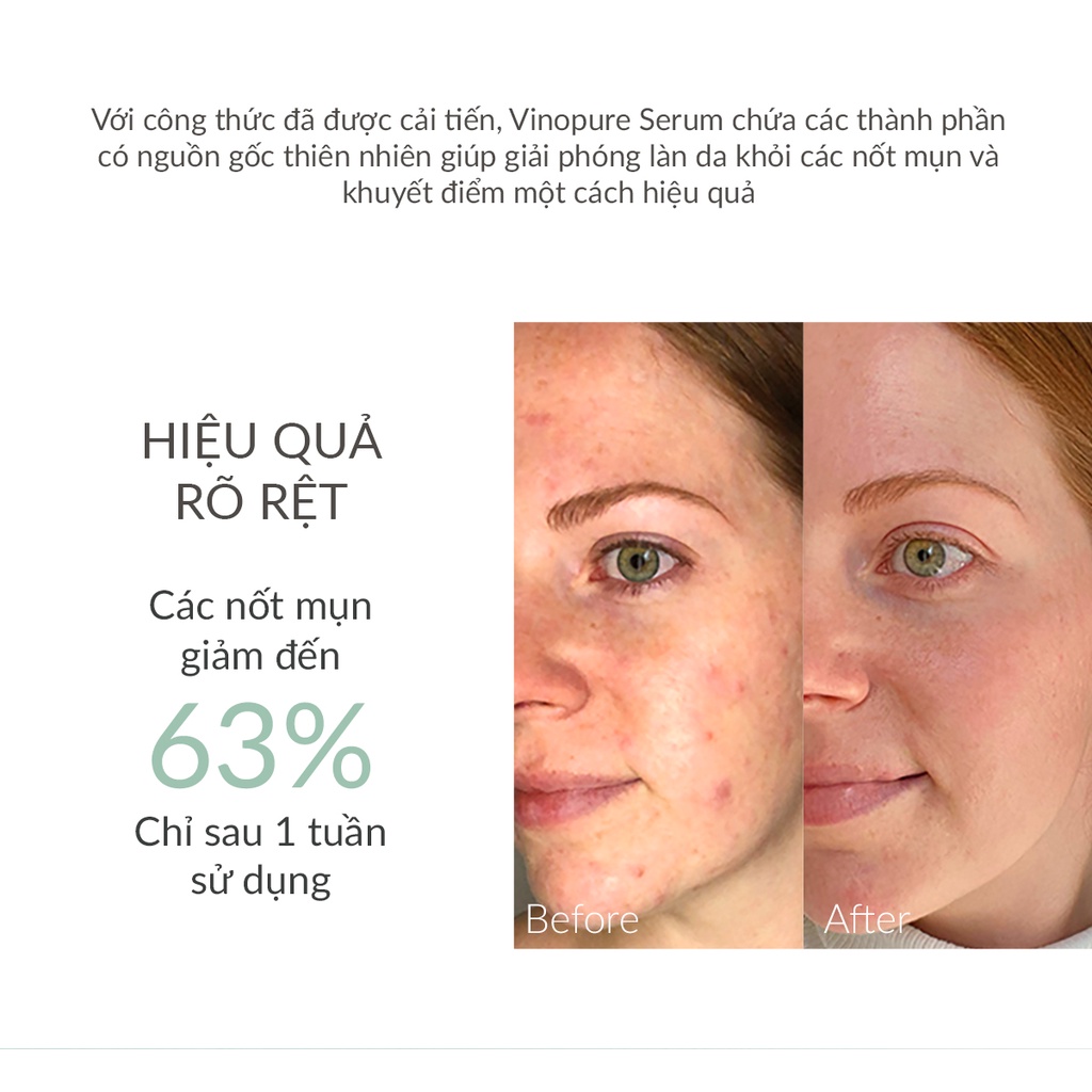 [Mã COSCAUDAT3 -8% đơn 250K] Serum kiểm soát và cải thiện mụn Caudalie Vinopure Blemish Control Salicylic Serum 30ml