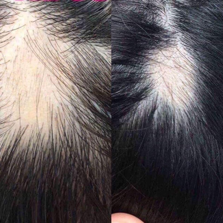 Tinh chất kích thích mọc tóc thảo dược Sato Nhật Bản 30ml giúp tóc chắc khỏe