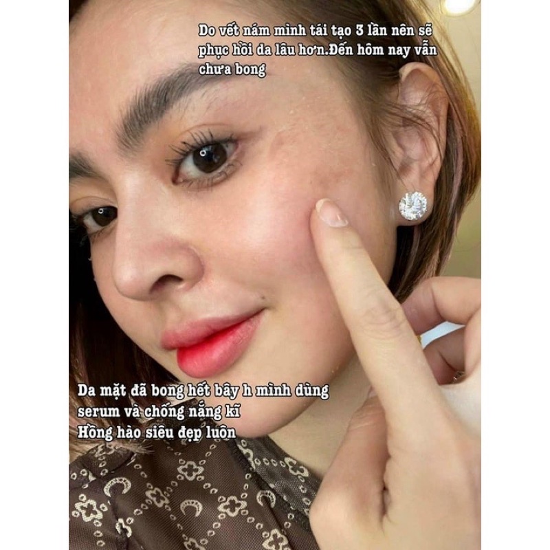 PEEL DA VI TẢO RETINOL TRANG NEMO HÀNG CHUẨN