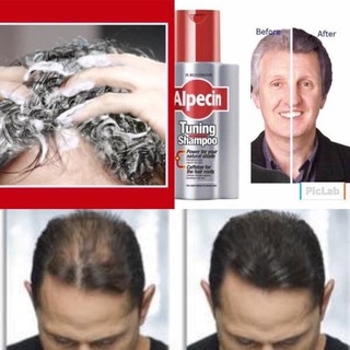 DẦU GỘI LÀM TÓC ĐEN ALPECIN TUNING SHAMPOO hàng Đức 200ml