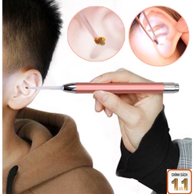 Bộ lấy ráy tai có đèn cho bé an toàn, hiệu quả