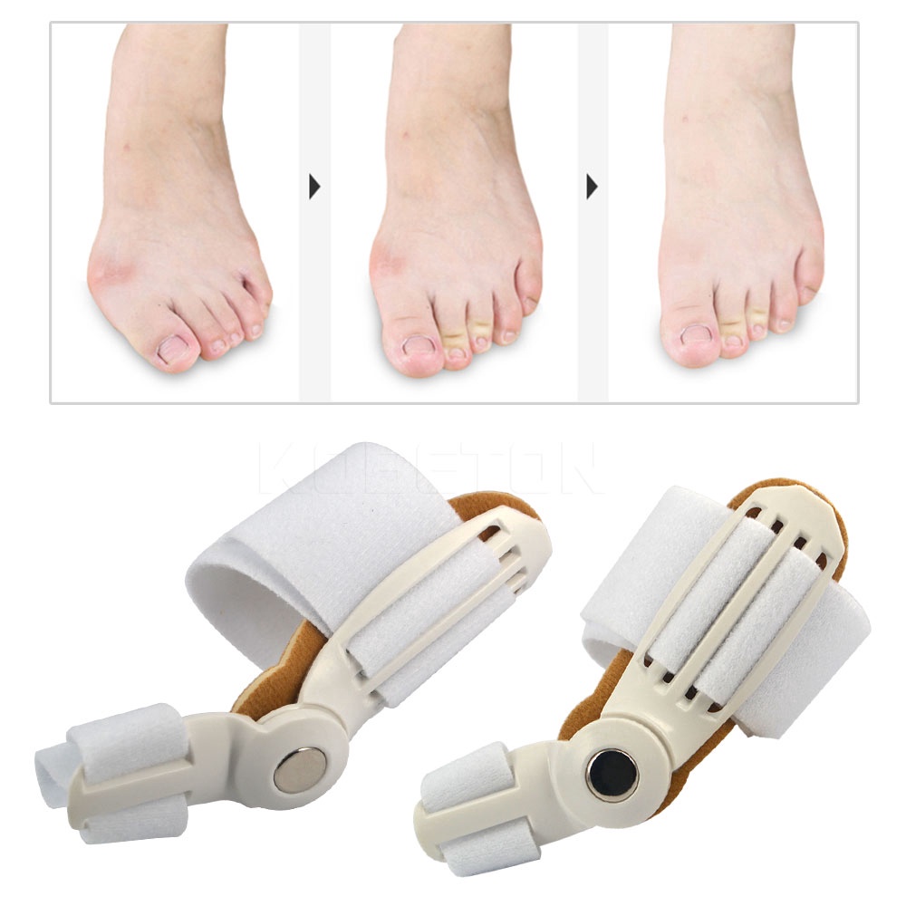 Nẹp Nẹp Chỉnh Hình Ngón Chân Cái Giảm Đau Chỉnh Hình Giảm Đau Chỉnh Hình