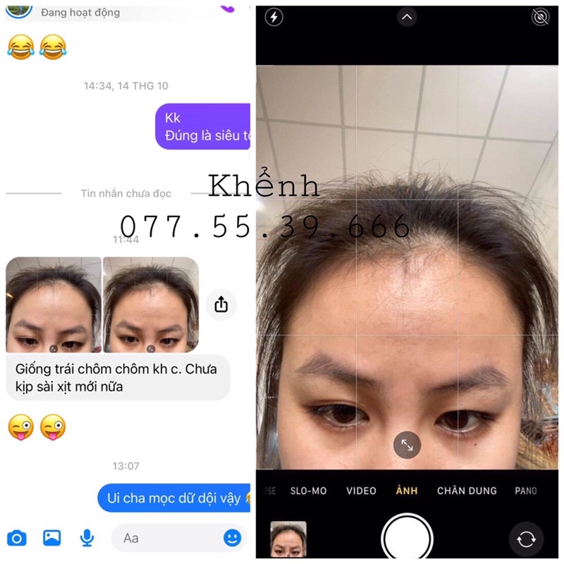 Dầu Ủ Oil Treatment Mọc Tóc Nhanh Dày Dài